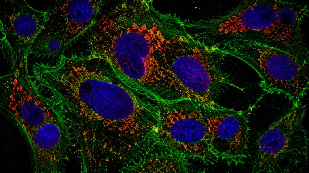 Fluorescence microscopy of cells analyzed in our molecular laboratory