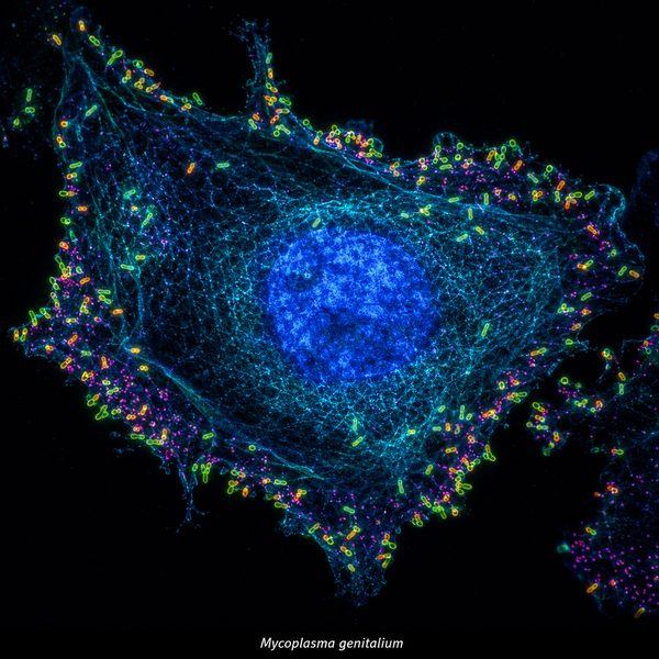 Mycoplasma genitalium — molecular fluorescence imaging