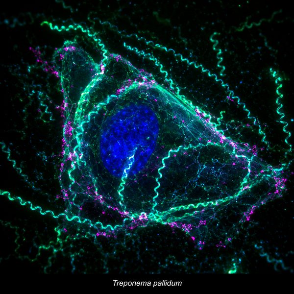 Syphilis — molecular fluorescence imaging