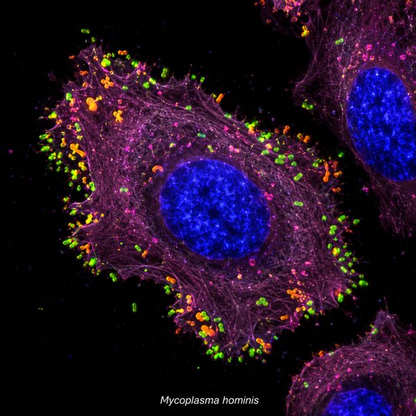 Mycoplasma hominis — molecular fluorescence imaging