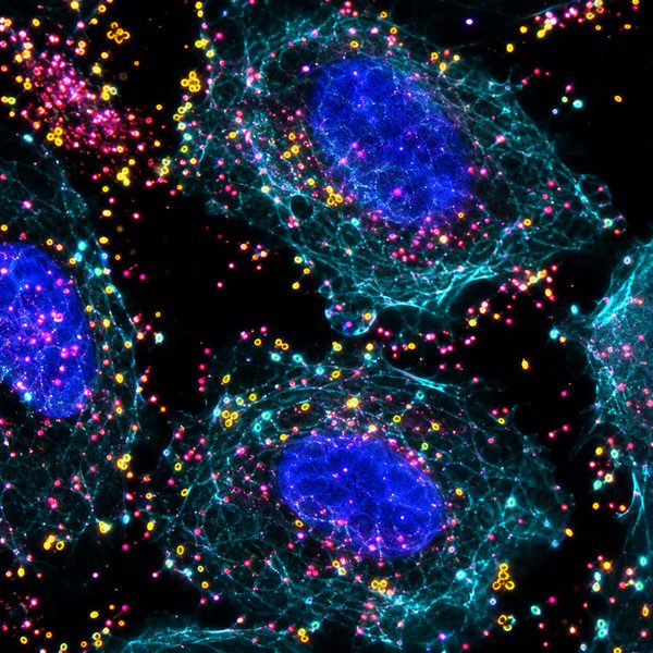 Ureaplasma — molecular fluorescence imaging