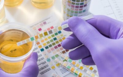 Best Test to Rule Out Both UTI and STD: What You Need to Know