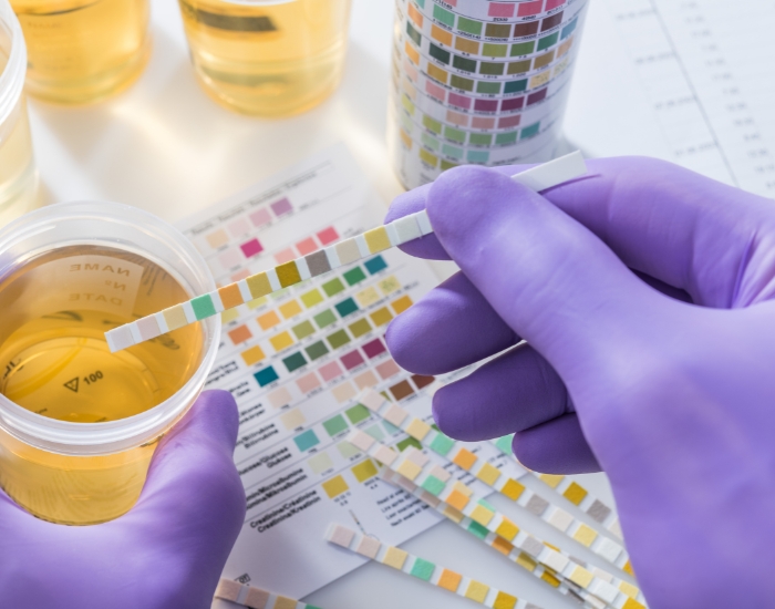 Best Test to Rule Out Both UTI and STD: What You Need to Know
