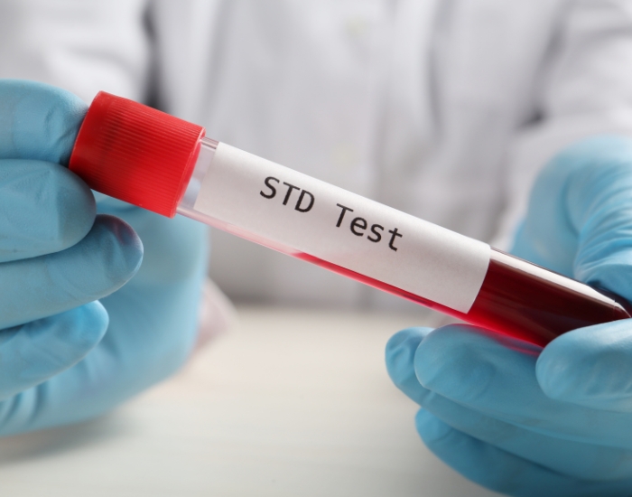 Sores, Blisters, or Ulcers (Herpes, Syphilis): What They Could Mean