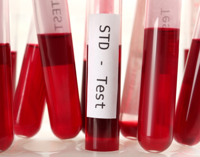 9ab8e0d7-screen-shot-2021-01-13-at-12-20-57-pm_1000000000000000000028 Emergency STD Testing Houston: Fast, Confidential & Accurate Lab Services