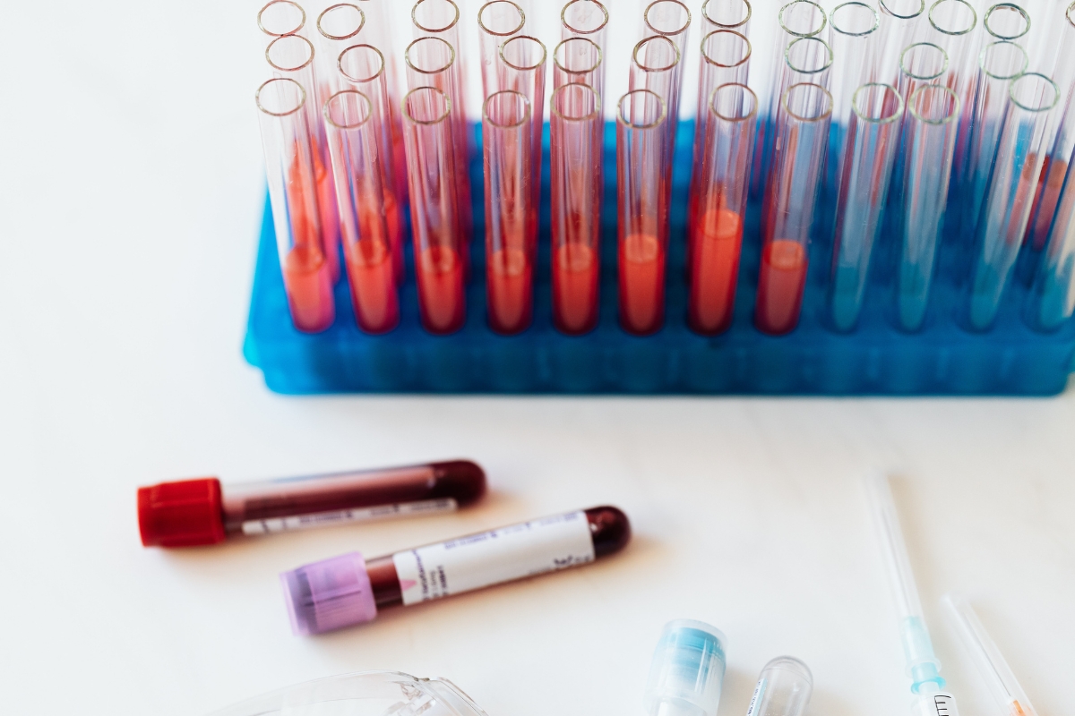 Confidential herpes testing in Houston for HSV-1 and cold sores